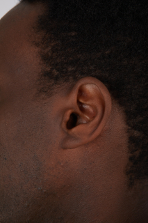 Photos of Deqavious Reese ear 0001.jpg